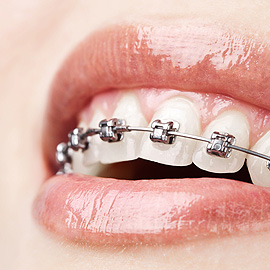 Orthodontics